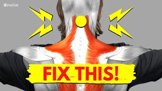 Symptoms of Cervical Stenosis  Jeffrey Cantor MD [upl. by Rep495]