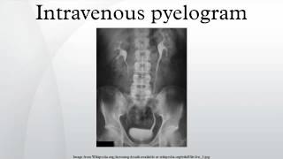 Intravenous pyelogram [upl. by Eleon]