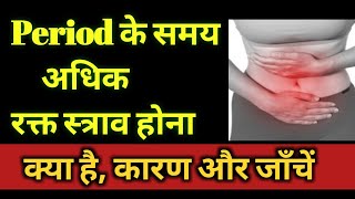 Menorrhagia Causes Investigation in hindi [upl. by Eendys]