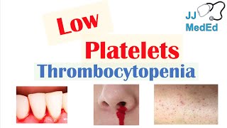 Immune thrombocytopenic purpura  an Osmosis Preview [upl. by Coral]