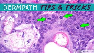 Dermatopathology Practical Tips amp Tricks for Pathology amp Dermatology [upl. by Elleinwad]