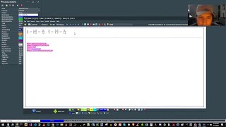 How To Use LaTeX In SuperMemo [upl. by Littman935]