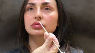 Lip Filler Injection Technique by Dr Tina Ho [upl. by Spense590]