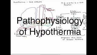 Hypothermia Pathophysiology [upl. by Andy]