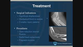 Elbow joint Muscles and nerves [upl. by Audres]