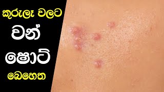 කුරුලෑ වලට වඩාත් සාර්ථක අත් බෙහෙත  Kurule Walata Sarala Behetha [upl. by Graeme]