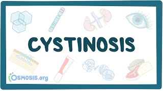 Cystitis Definition Causes and Epidemiology – Infectious Diseases  Lecturio [upl. by Asreht]