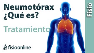 Neumotórax Qué es consejos y tratamiento a través de la fisioterapia respiratoria [upl. by Amoeji]