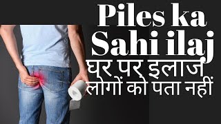 Piles treatment at home in Hindi  Bavasir ka ilaj [upl. by Gesner849]