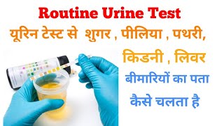 urine routine test explain in Hindi  urine test normal range [upl. by Adkins]