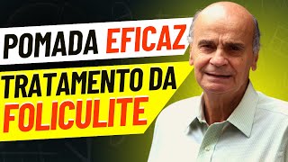 Pomada para foliculite Conheça o MELHOR tratamento [upl. by Aissert]