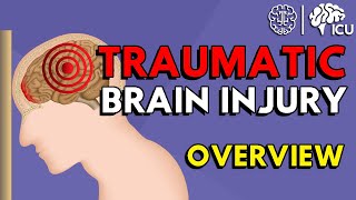 Overview of Traumatic Brain Injury TBI [upl. by Darbee795]