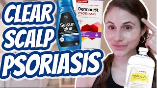 How to CLEAR SCALP PSORIASIS Dr Dray [upl. by Ahseket]