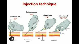 All You Need To Know About Joint Injections [upl. by Suollecram666]