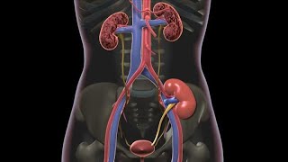 Symptoms of Kidney Stone  Dr Nicholas Laryngakis [upl. by Steere]