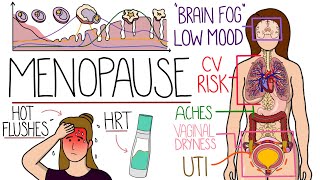 Menopause Explained Clearly Includes HRT amp Perimenopause [upl. by Ammon940]