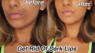 How To Get rid Of Dark Lips And Pigmentation [upl. by Laverne]