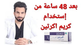 طريقة استخدام اكرتين لعلاج حب الشباب Acretin cream دكتور طلال المحيسن [upl. by Ardnossak]