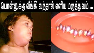 பொன்னுக்கு வீங்கி வந்தால் எளிய மருத்துவம்  Home Remedi For Mumps [upl. by Hannasus]