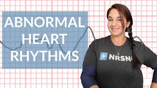 EKG like a BOSS Part 3  Abnormal Heart Rhythms [upl. by Kaenel933]