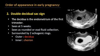 Ultrasound of normal early pregnancy [upl. by Ahsha155]