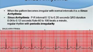 EKG like a BOSS Part 2  The 5 Step Method [upl. by Doowyah]