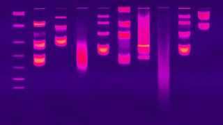 Gel Electrophoresis [upl. by Oinegue36]