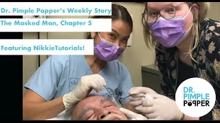 Dr Pimple Poppers Weekly Story The Masked Man with NikkieTutorials [upl. by Aikmat]