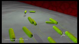 What Are Bacterial Biofilms A Six Minute Montage [upl. by Luing923]