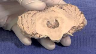 The Cerebellum Neuroanatomy Video Lab  Brain Dissections [upl. by Armelda998]