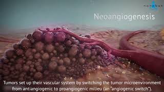 Tumor growth  3D medical animation [upl. by Spense]