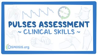 Clinical Skills Pulses assessment [upl. by Yecies]