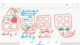 🔴 ASTUCE CARDIOPATHIES CONGENITALES   DR ASTUCE [upl. by Medora]