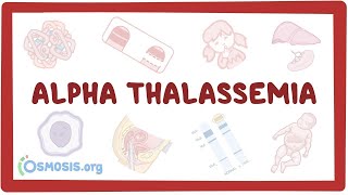 Alphathalassemia  an Osmosis Preview [upl. by Aspa]