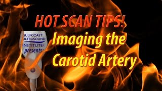 Hot Tip  Imaging The Carotid Artery [upl. by Kennan]