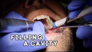 How Does A Dentist Fill A Cavity [upl. by Bail64]