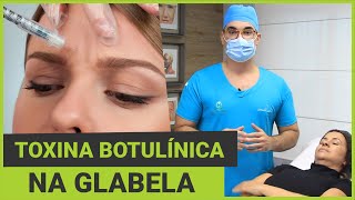 Botox®  Toxina Botulínica na Glabela [upl. by Orlan]