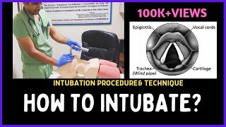 HOW TO INTUBATE INTUBATION PROCEDURE amp TECHNIQUE [upl. by Toth]