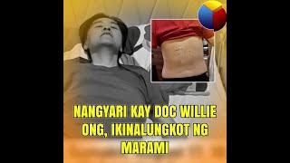 Nangyari kay Doc Willie Ong ikinalungkot ng marami [upl. by Notliw]