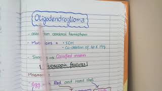 Rethinking Vestibular Schwannoma [upl. by Nelehyram]