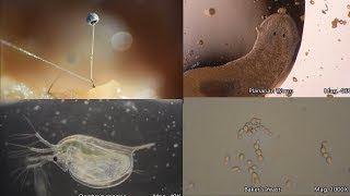 The Amazing Microscopic World [upl. by Eizzik]