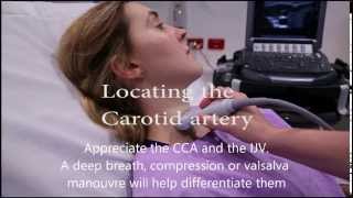 Carotid flow measurement video [upl. by Helbonia261]