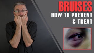 FILLER BRUISES Dr Tims 16 Essential Tips To Prevent amp Minimise Bruises Aesthetics Mastery Show [upl. by Ocicnarf649]