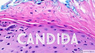 Candida Yeast Infection under microscope Candidiasis Dermatology Dermatopathology [upl. by Aisha]