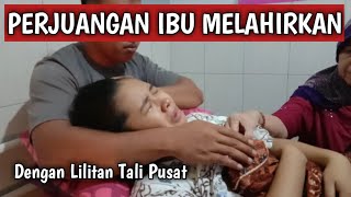 PROSES MELAHIRKAN NORMAL ANAK PERTAMA  DENGAN LILITAN TALI PUSAT [upl. by Enom]