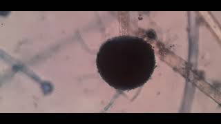 Fungus under Microscope Fungal structures Aspergillus [upl. by Attaynek263]