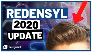 Redensyl 2020 Updates For YOUR Hair GROWTH [upl. by Dnarud]