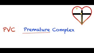 Premature Ventricular Contractions PVC Interpretation Easy and Simple [upl. by Adalbert224]