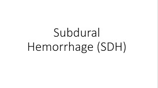 Subdural Hemorrhage SDH  General Surgery [upl. by Thilde]