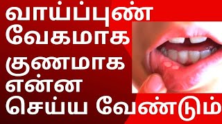 வாய் புண் வேகமாக குணமாக  vaai pun treatment in tamil  Mouth Ulcer Treatment [upl. by Olrac]